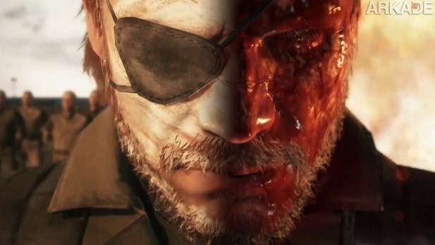 Morte, loucura e insanidade no novo trailer de Metal Gear Solid V (que vazou antes da hora)!